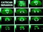 Cover: Catscan - Tecret